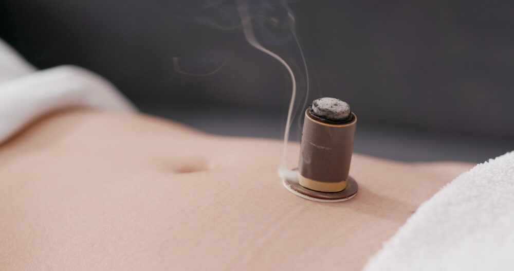 moxabustion moxabustion burning placed on the stomach after acupuncture