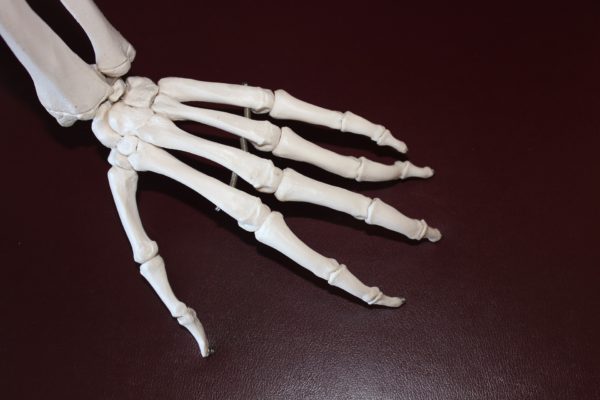 Read more about the article What You Need To Know About A Scaphoid Fracture: A Physio perspective